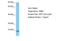 CNBP Antibody, Novus Biologicals 100 &mu;L | Buy Online | Novus Biologicals | Fisher Scientific